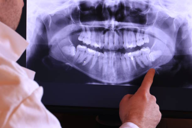 Best Emergency TMJ Treatment in Hancock, MI