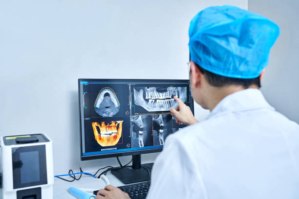 Best Emergency Wisdom Teeth Removal in Hancock, MI