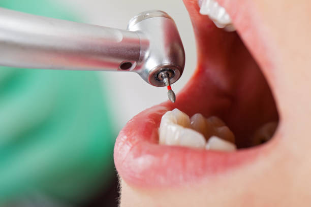 Best Emergency Treatment for Dental Infections or Abscesses in Hancock, MI